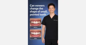 Can veneers change small, pointed teeth?