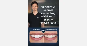 Veneers or reshaping for uneven teeth?